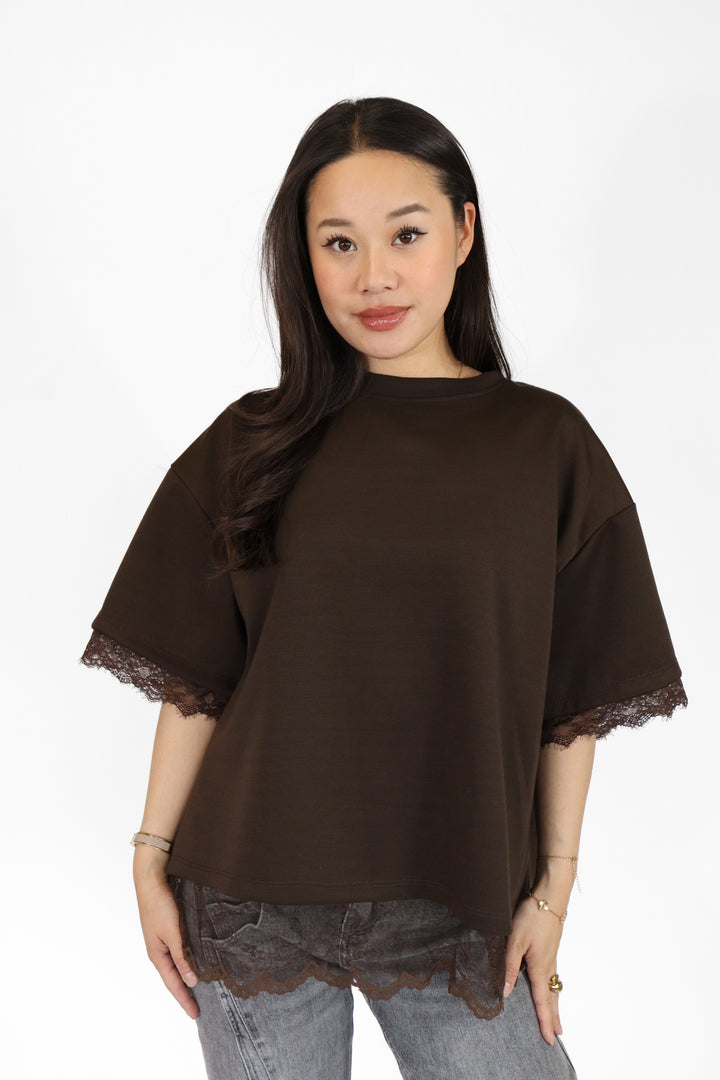 Lace Oversized Shirt